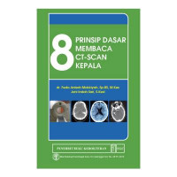Image of 8 Prinsip Dasar Membaca CT-SCAN Kepala