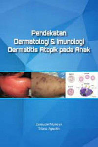 Image of Pendekatan Dermatologi dan Imunologi Dermatitis Atopik pada Anak