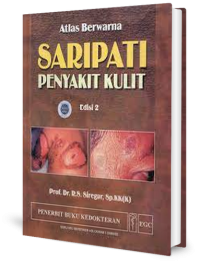 Image of Atlas berwarna saripati penyakit kulit