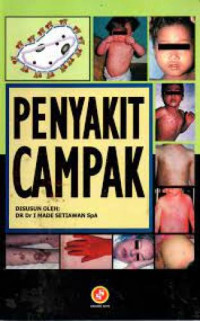 Image of Penyakit Campak