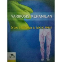 Image of Varikosis Kehamilan