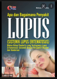 Apa dan bagaimana penyakit lupus (sistemik lupus eritematosus)