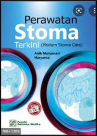 Perawatan Stomata Terkini ( Modern Stoma Care)