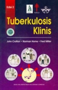 Image of Tuberkolosis Klinis