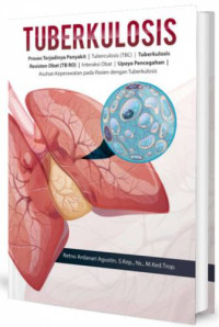 Image of Tuberkulosis