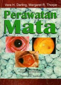 Image of Perawatan Mata